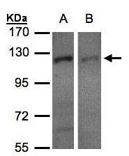 Sample (30 ug of whole cell lysate). A:H1299. B:HeLa S3. 7.5% SDS PAGE. TA308353 diluted at 1:500