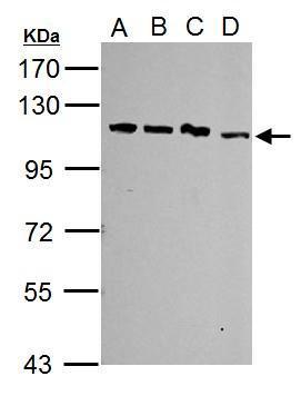 Sample (30 ug of whole cell lysate). A: Jurkat. B: Raji. C: K562. D: NCI-H929. 7.5% SDS PAGE. TA307946 diluted at 1:5000.