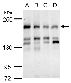 CSB antibody [N2C1], Internal detects CSB protein by western blot analysis. A. 30 ug 294T whole cell lysate/extract. B. 30 ug A432 whole cell lysate/extract. C. 31 ug HeLa whole cell lysate/extract. D. 30 ug HepG3 whole cell lysate/extract. 5 % SDS-PAGE.