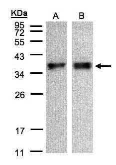 Sample (30 ug of whole cell lysate). A:A431. B:HeLa S3. 12% SDS PAGE. TA308996 diluted at 1:500