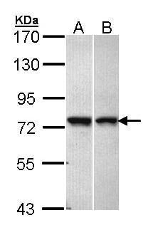 Sample (30 ug of whole cell lysate). A: A431. B: Hela. 7.5% SDS PAGE. TA308857 diluted at 1:1000.