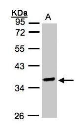 Sample (30 ug whole cell lysate). A:Raji. 10% SDS PAGE. TA308063 diluted at 1:2000