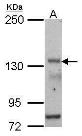 Sample (30 ug of whole cell lysate). A: HCT116. 5% SDS PAGE. TA308085 diluted at 1:500.
