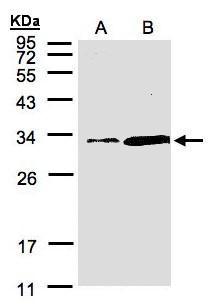 Sample (30 ug of whole cell lysate). A:Hep G2. B:MOLT4. 12% SDS PAGE. TA308387 diluted at 1:1500