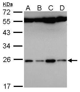 Sample (30 ug of whole cell lysate). A: Hela. B: Hep G2. C: Molt-4. D: Raji. 12% SDS PAGE. TA309058 diluted at 1:5000.