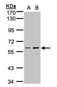 Sample (30ug whole cell lysate). A:Hep G2. B:MOLT4. 7.5% SDS PAGE. TA309034 diluted at 1:1000