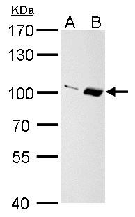 Importin 13 antibody [C3], C-term detects Importin 13 protein by Western blot analysis. A. 30 ug PC-12 whole cell lysate/extract. B. 30 ug Rat2 whole cell lysate/extract. 7.5 % SDS-PAGE. Importin 13 antibody [C3], C-term (TA307937) dilution: 1:1000
