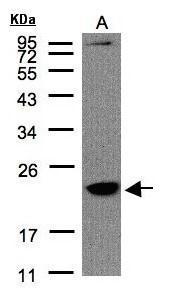 Sample (30 ug of whole cell lysate). A:Raji. 12% SDS PAGE. TA308988 diluted at 1:1500