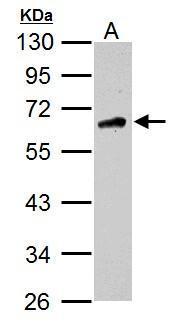 Host: Rabbit; Target Name: CD81; Sample Tissue: Placenta lysates; Antibody Dilution: 1.0ug/ml