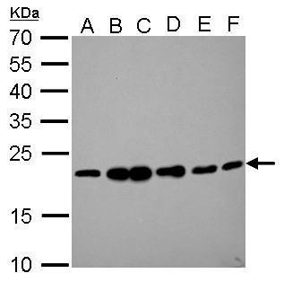 RAMP2 antibody detects RAMP2 protein by Western blot analysis. A. 30 ug Jurkat whole cell lysate/extract. B. 30 ug Raji whole cell lysate/extract. C. 30 ug K562 whole cell lysate/extract. D. 30 ug THP-1 whole cell lysate/extract. E. 30 ug HL-60 whole cell