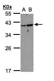 Sample (30 ug whole cell lysate). A:MOLT4. B:Raji. 12% SDS PAGE. TA309035 diluted at 1:1000