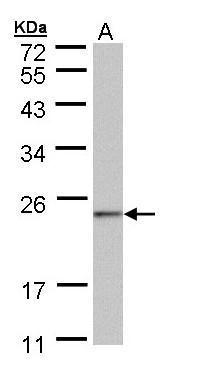 Sample (30 ug of whole cell lysate). A: 293T. 12% SDS PAGE. TA309008 diluted at 1:1000