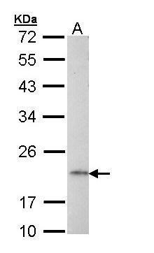 WB Suggested Anti-NONO Antibody Titration: 1.25ug/ml; ELISA Titer: 1: 312500; Positive Control: HepG2 cell lysate
