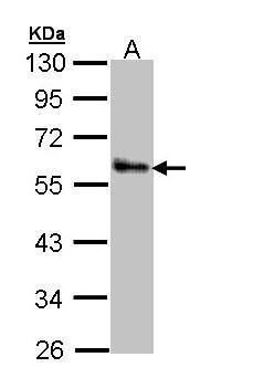 Sample (30 ug of whole cell lysate). A: A431. 10% SDS PAGE. TA308253 diluted at 1:1000.