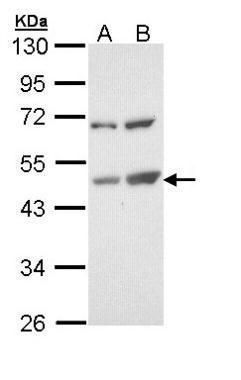Sample (30 ug of whole cell lysate). A: Molt-4. B: Raji. 10% SDS PAGE. TA307908 diluted at 1:1000.