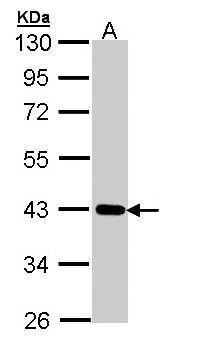 WB Suggested Anti-SEPT1 Antibody Titration: 0.2-1ug/ml; ELISA Titer: 1:62500; Positive Control: NCI-H226 cell lysate