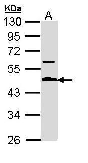 Sample (30 ug of whole cell lysate). A: A431. 10% SDS PAGE. TA308556 diluted at 1:1000.