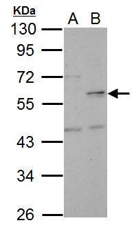 Sample (30 ug of whole cell lysate). A: HeLa. B: HeLa nucleus. 10% SDS PAGE. TA307991 diluted at 1:5000.