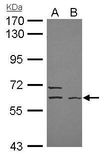 ELP3 antibody [N3C3] detects ELP3 protein by Western blot analysis. A. 30 ug NT2D1 whole cell lysate/extract. B. 30 ug IMR32 whole cell lysate/extract. 7.5 % SDS-PAGE. ELP3 antibody [N3C3] (TA308480) dilution: 1:2000