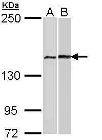 WB Suggested Anti-E2F2 Antibody Titration: 0.2-1ug/ml; ELISA Titer: 1: 1562500; Positive Control: Human brain