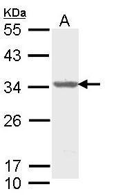 Sample (30 ug of whole cell lysate). A: Molt-4. 12% SDS PAGE. TA307902 diluted at 1:1000.