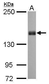 Liprin alpha 1 antibody [N1N2], N-term detects PPFIA1 protein by Western blot analysis. A. 30 ug Neuro2A whole cell lysate/extract. 5 % SDS-PAGE. Liprin alpha 1 antibody [N1N2], N-term (TA308315) dilution: 1:1000