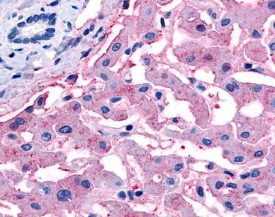 Anti-SLC5A4 antibody IHC of human liver. Immunohistochemistry of formalin-fixed, paraffin-embedded tissue after heat-induced antigen retrieval.
