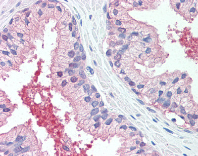 Anti-CADM2 antibody IHC of human prostate. Immunohistochemistry of formalin-fixed, paraffin-embedded tissue after heat-induced antigen retrieval.