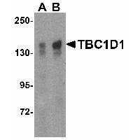 WB Suggested Anti-SET Antibody Titration: 0.2-1ug/ml; ELISA Titer: 1: 1562500; Positive Control: Human Spleen