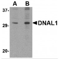 Western blot analysis of DNAL1 in 3T3 cell lysate with DNAL1 antibody at (A) 1 and (B) 2ug/ml.