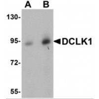 Western blot analysis of DCLK1 in human brain tissue lysate with DCLK1 antibody at (A) 0.5 and (B) 1ug/ml.