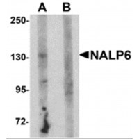 Western blot analysis of NALP6 in human heart tissue lysate with NALP6 antibody at 1 ug/ml in (A) the absence and (B) the presence of blocking peptide.
