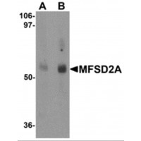 Western blot analysis of MFSD2A in rat lung tissue lysate with MFSD2A antibody at (A) 1 and (B) 2ug/ml.