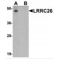 Western blot analysis of LRRC26 in human prostate tissue lysate with LRRC26 antibody at 0.5ug/ml in (A) the absence and (B) the presence of blocking peptide.