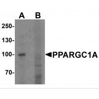 Western blot analysis of PPARGC1A in human heart tissue lysate with PPARGC1A antibody at 1ug/ml in (A) the absence and (B) the presence of blocking peptide.