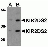 Western blot analysis of KIR2DS2 in 293 cell lysate with KIR2DS2 antibody at (A) 1 and (B) 2ug/ml.