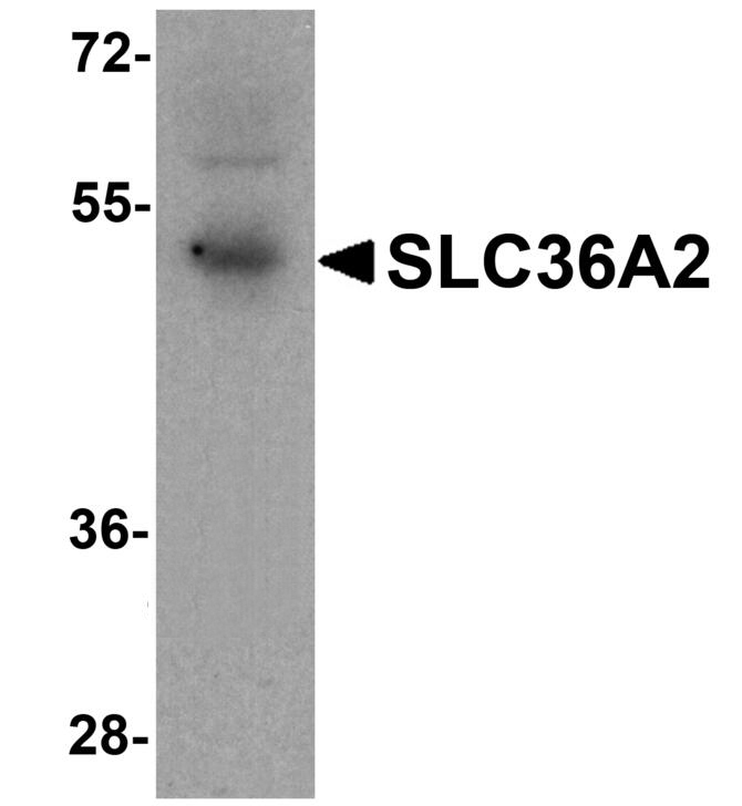 Western blot analysis of SLC36A2 in human stomach tissue lysate with SLC36A2 antibody at 1ug/ml.
