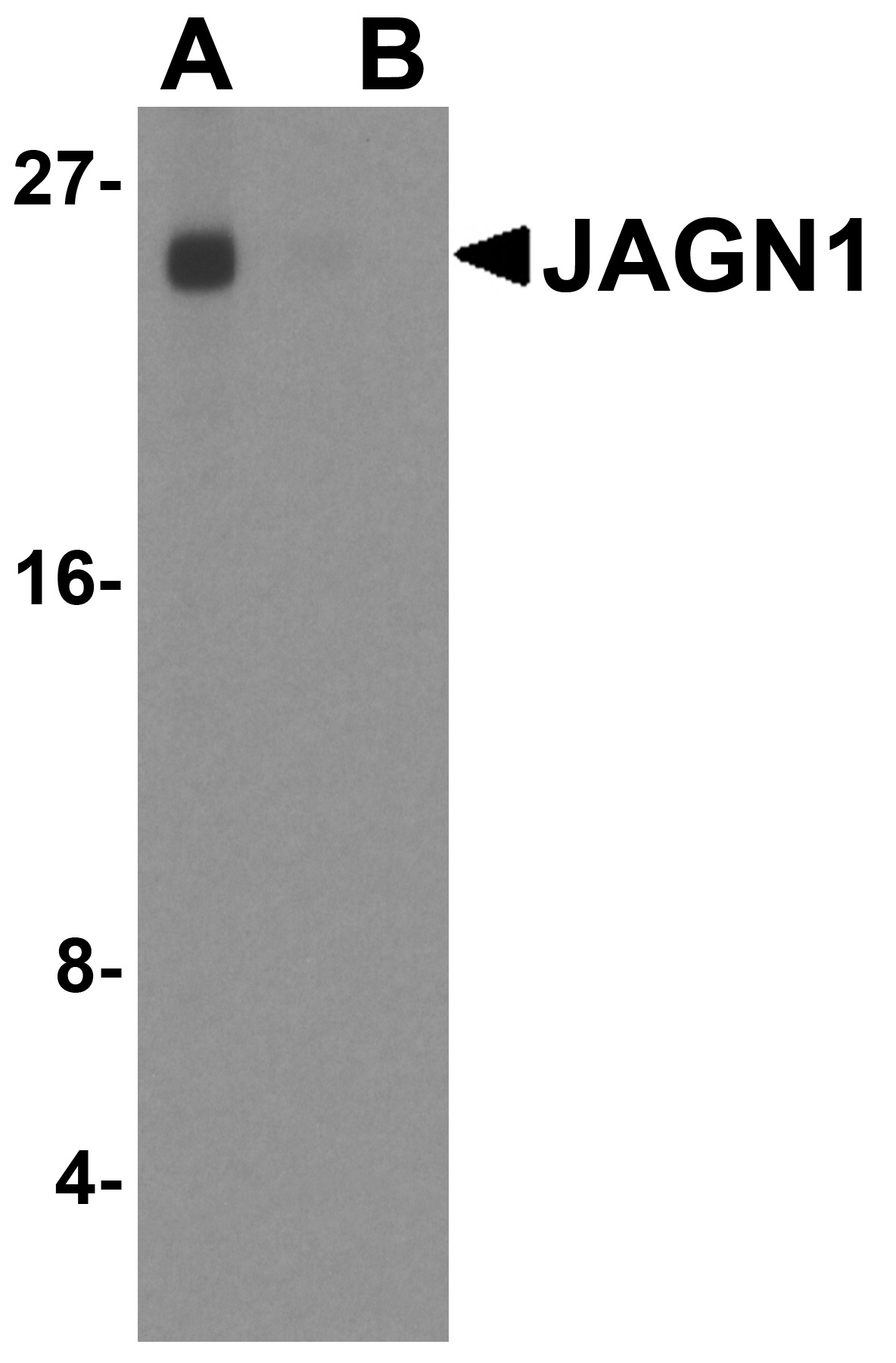 Western blot analysis of JAGN1 in MCF7 cell lysate with JAGN1 antibody at 1ug/ml in (A) the absence and (B) the presence of blocking peptide.