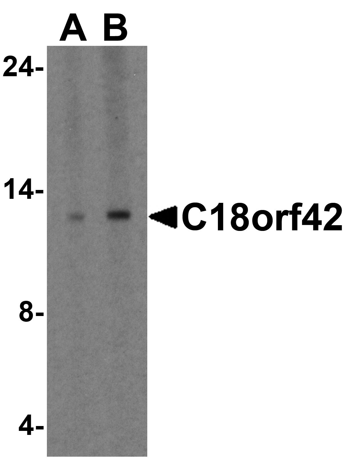 Western blot analysis of C18orf42 in HeLa cell lysate with C18orf42 antibody at 1ug/ml.