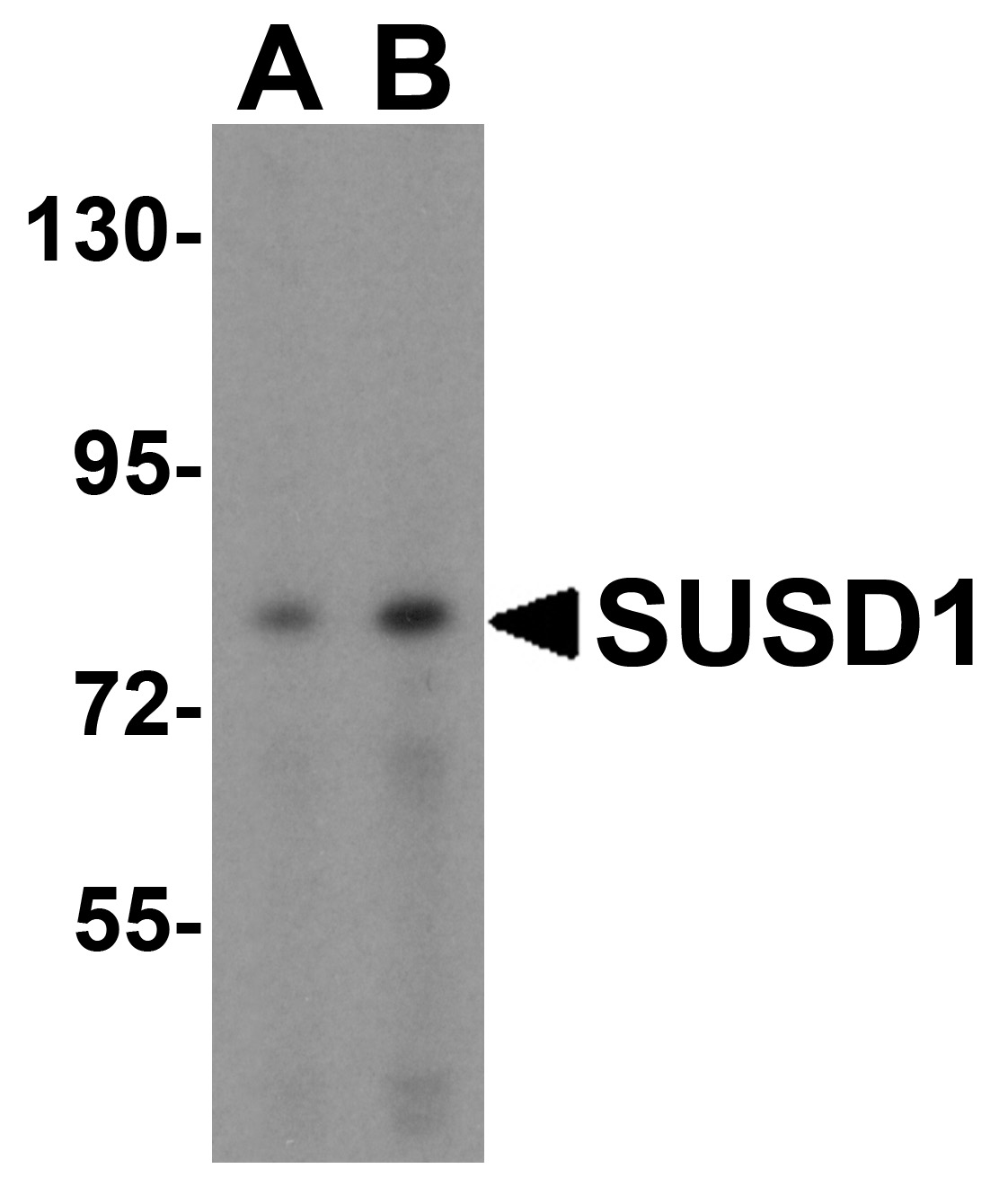 Western blot analysis of SUSD1 in 293 cell lysate with SUSD1 antibody at (A) 0.5 and (B) 1ug/ml.