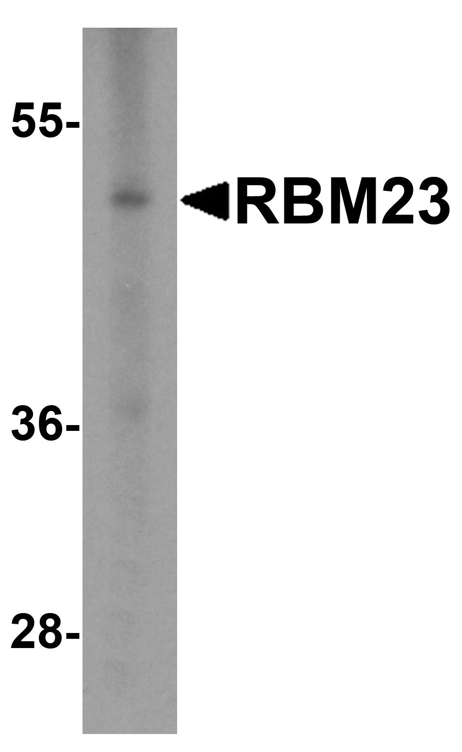 Western blot analysis of RBM23 in (A) human tonsil and (B) rat stomach tissue lysate with RBM23 antibody at 1ug/ml.