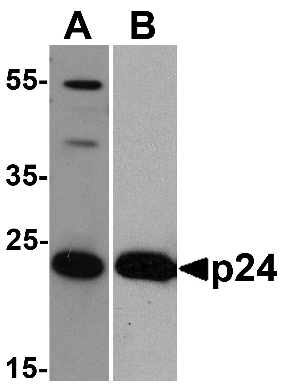 /assets/images/antibody/110/pm-6335-1-w.jpg