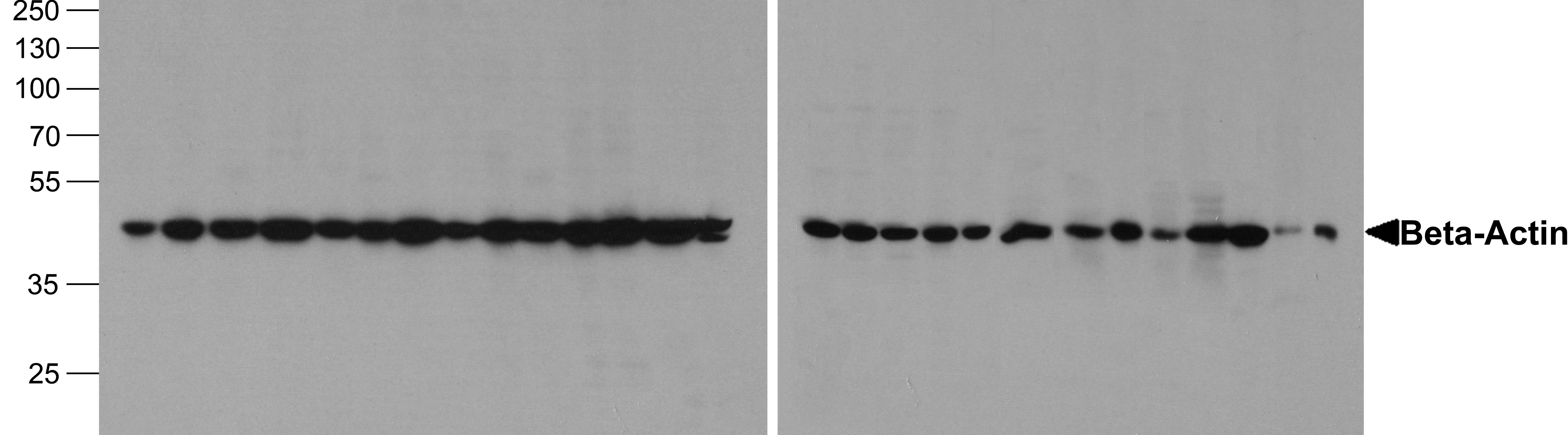 Western blot analysis of extracts of various cell lines, using SENP6 antibody (TA381358) at 1:1000 dilution.|Secondary antibody: HRP Goat Anti-Rabbit IgG (H+L) at 1:10000 dilution.|Lysates/proteins: 25ug per lane.|Blocking buffer: 3% nonfat dry milk in TBST.|Detection: ECL Basic Kit .|Exposure time: 30s.
