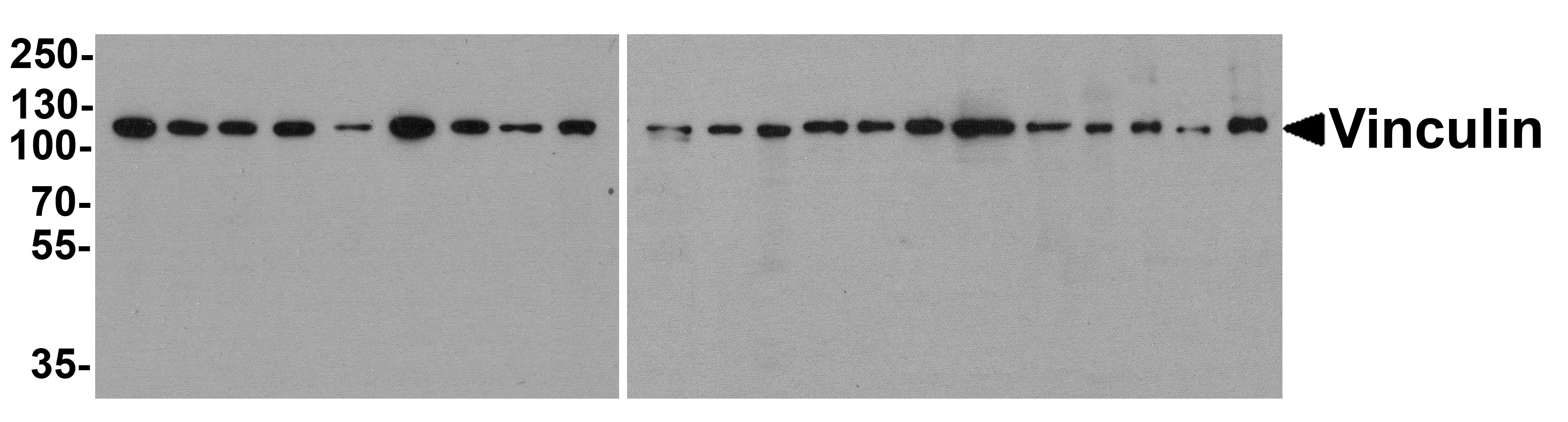 Western blot analysis of extracts of various cell lines, using SEPSECS Antibody (TA381362) at 1:1000 dilution.|Secondary antibody: HRP Goat Anti-Rabbit IgG (H+L) at 1:10000 dilution.|Lysates/proteins: 25ug per lane.|Blocking buffer: 3% nonfat dry milk in TBST.|Detection: ECL Basic Kit .|Exposure time: 3s.
