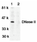 Western blot analysis of DNase II in human spleen tissue lysate in the absence (lane 1) or presence (lane 2) of blocking peptide with DNase antibody II at 1:500 dilution.