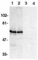 Western blot analysis of SODD in HeLa (1, 3) and THP-1 (2, 4) whole cell lysates in the absence (1, 2) or presence (3, 4) of blocking peptide (Catalog no. 2143P) with SODD antibody at 1:500 dilution.