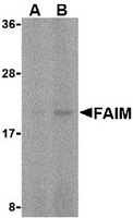 Western blot analysis of FAIM in human spleen tissue lysate with FAIM antibody at (A) 5 and (B) 10 ug/ml.