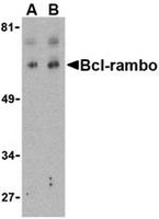 Western blot analysis of Bcl-rambo in K562 cell lysate with Bcl-rambo antibody at (A) 2 and (B) 4 ug/ml.