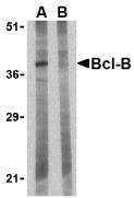 Western blot analysis of Bcl-B in Jurkat lysate with Bcl-B antibody at 1 ug/ml in the (A) absence and (B) presence of blocking peptide.