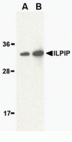 Western blot analysis of ILPIP in human brain lysate with ILPIP antibody at (A) 1 and (B) 2 ug/ml.